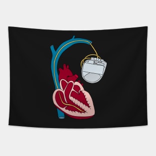Heart Defi medicine Design Tapestry