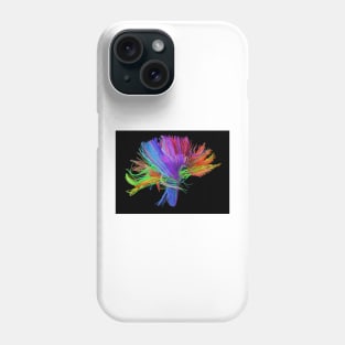 White matter fibres of the human brain (C023/9414) Phone Case