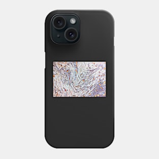 GlowBark Phone Case