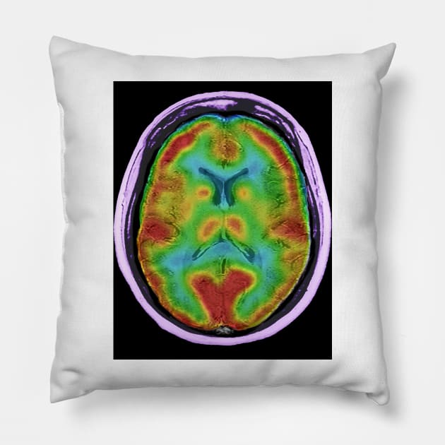Normal brain blood flow, MRI and SPECT (C026/8000) Pillow by SciencePhoto