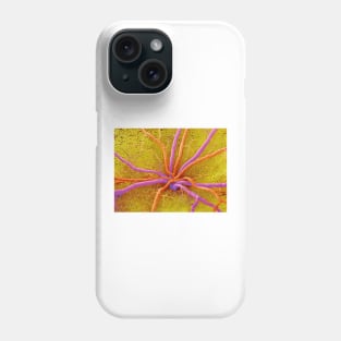 Retina (P424/0192) Phone Case