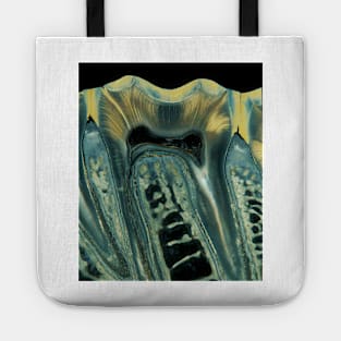 Tooth, light micrograph (C028/6621) Tote