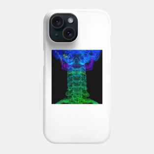 Cervical spine anatomy, 3D CT scan (C034/5265) Phone Case