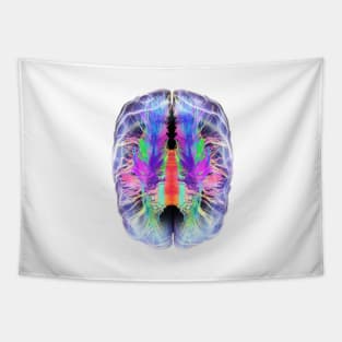 White matter fibres and brain, artwork (C028/6324) Tapestry