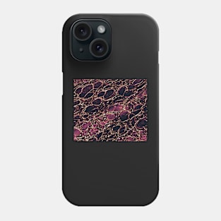 Bordeaux cells abstract art. Phone Case