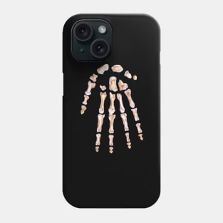 Hand anatomy Phone Case