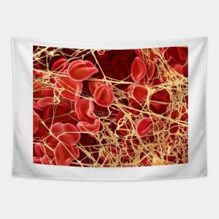 Blood clot, SEM (P260/0107) Tapestry