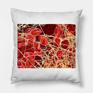 Blood clot, SEM (P260/0107) Pillow