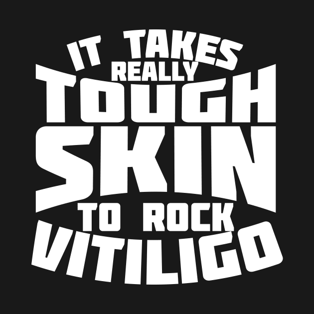 It Takes Really Tough Skin To Rock Vitiligo by thingsandthings