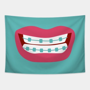 Woman smiling with teeth braces Tapestry