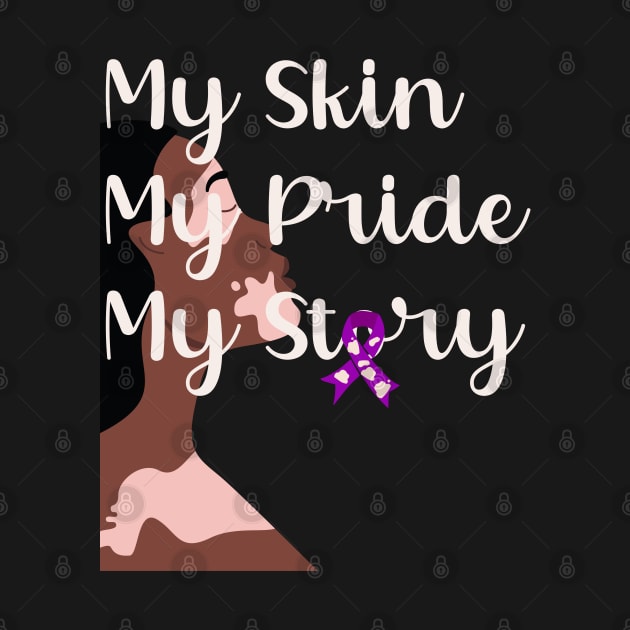 Black Woman with Vitiligo My Skin My Pride My Story Vitiligo Awareness and Acceptance by Mind Your Tee