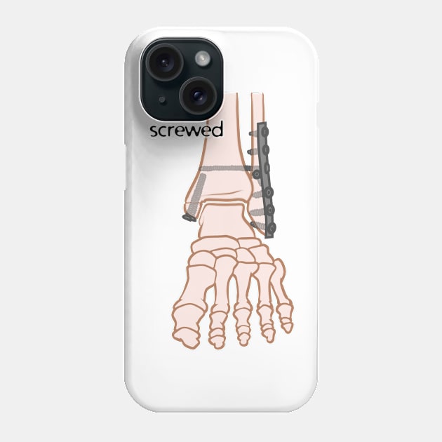 screwed Phone Case by MilesNovelTs