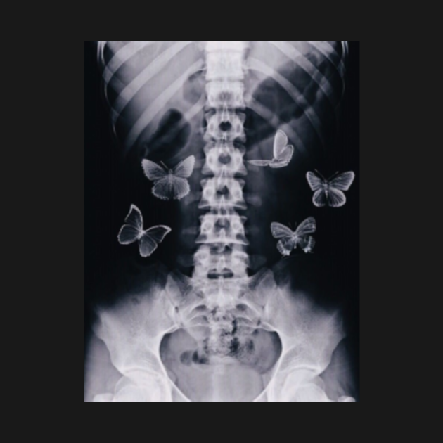 Butterflies in my stomach Butterflies Body Niemowlęce TeePublic PL