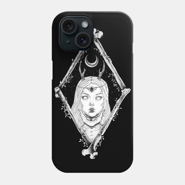 Bones Phone Case by alesaenz