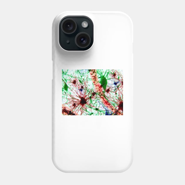 Brain cells, illustration (F013/1488) Phone Case by SciencePhoto