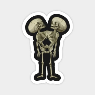 Siamese Twins Skeleton Magnet