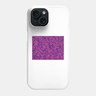 Dark matter distribution (R980/0209) Phone Case