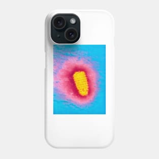 TEM of rabies virus (M050/0056) Phone Case