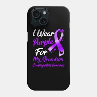 I Wear Purple For MY  Craniosynostosis Awareness Phone Case