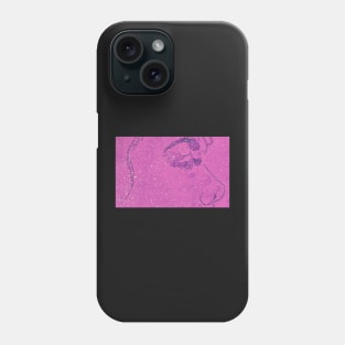 Glitter Moonwalker No. 5 Phone Case