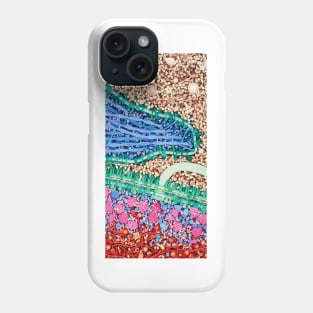 Macrophage engulfing bacterium, artwork (P276/0203) Phone Case