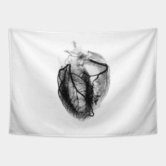 Coronary arteriogram of arteries of the heart 1904 (P216/0201) Tapestry by SciencePhoto