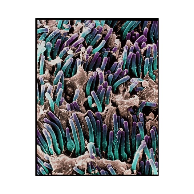 Coloured SEM of rod cells in the retina of the eye (P424/0124) by SciencePhoto