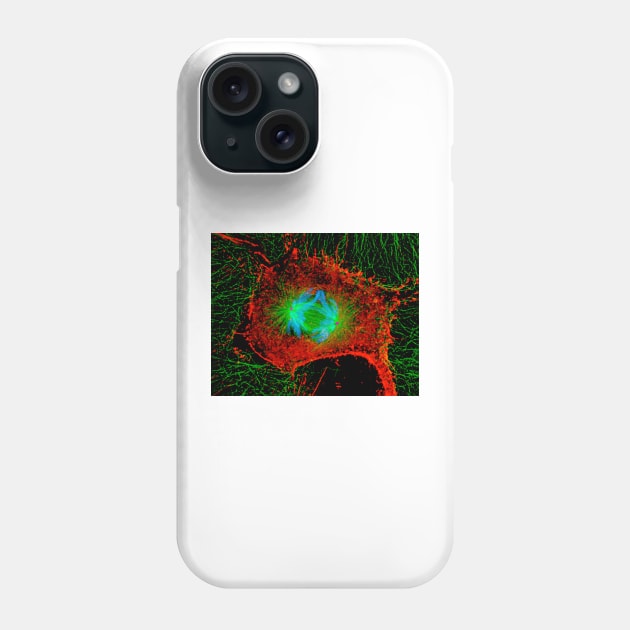 Mitosis cell division (P673/0055) Phone Case by SciencePhoto