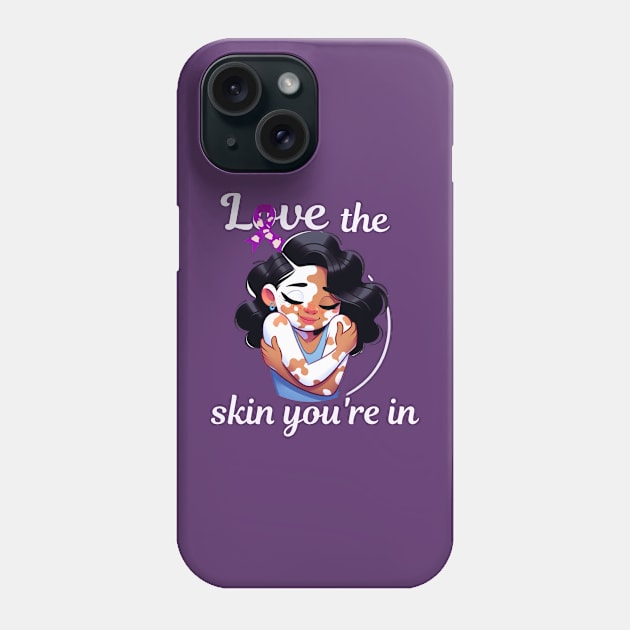 Love The Skin You're In Vitiligo Awareness and Acceptance Phone Case by Mind Your Tee