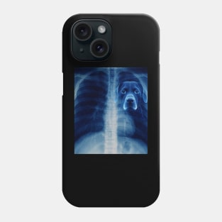 I GOT THAT DOG IN ME Xray chest Phone Case