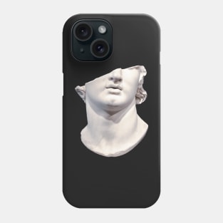 Broken Greek Bust- Fragmentary colossal head of a youth Phone Case