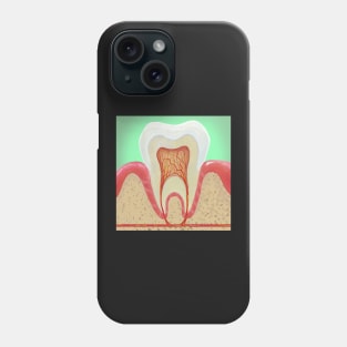 Medical illustration Tooth Anatomy Phone Case