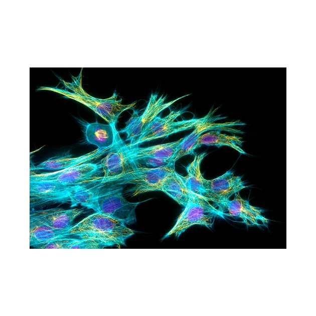 Fibroblast cells, fluorescent micrograph (C010/3469) by SciencePhoto