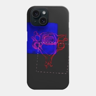 4th Cervical Vertebra Phone Case