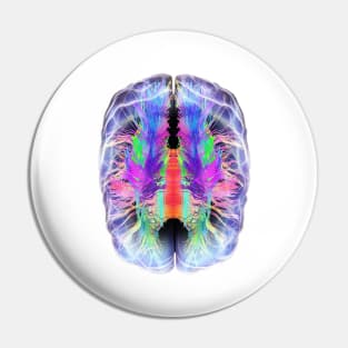 White matter fibres and brain, artwork (C028/6324) Pin