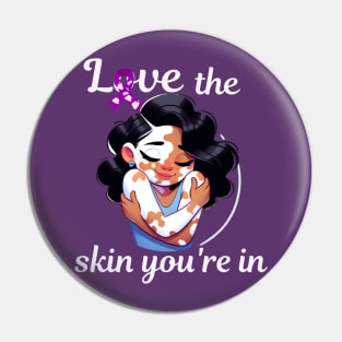 Love The Skin You're In Vitiligo Awareness and Acceptance Pin