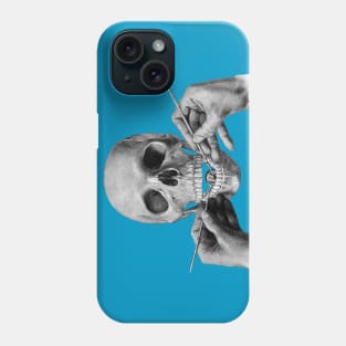 The Dental Exam Phone Case