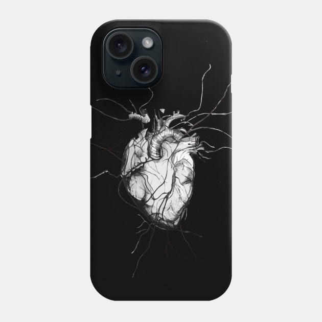 Anatomical Heart heart disease awareness Phone Case by Collagedream