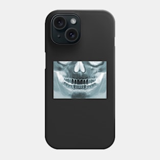 Killer Masks - Skull X-Ray Phone Case