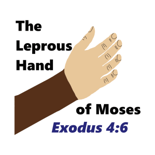 Moses was Black - The Leprous Hand of Moses - Exodus 4:6 - Put now thine hand into thy bosom. T-Shirt