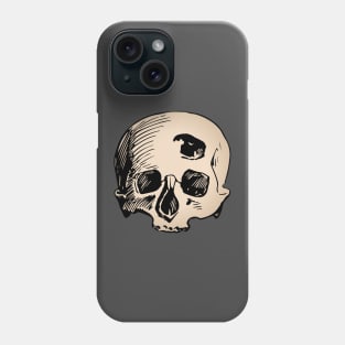 Human skull with bullet hole Phone Case