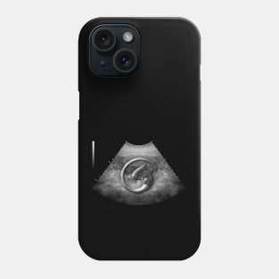 Alien on Board - Ultrasound Phone Case