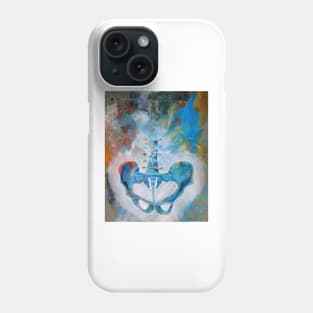 Elvis the Pelvis Phone Case