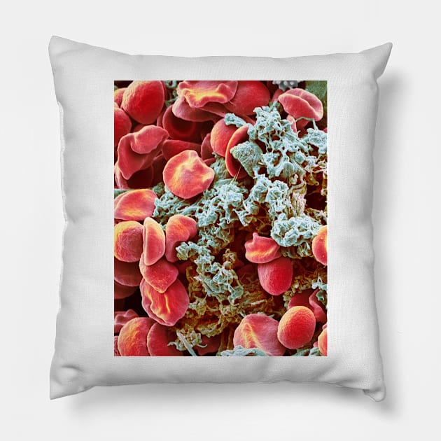 Red blood cells and platelets, SEM (F013/1526) Pillow by SciencePhoto