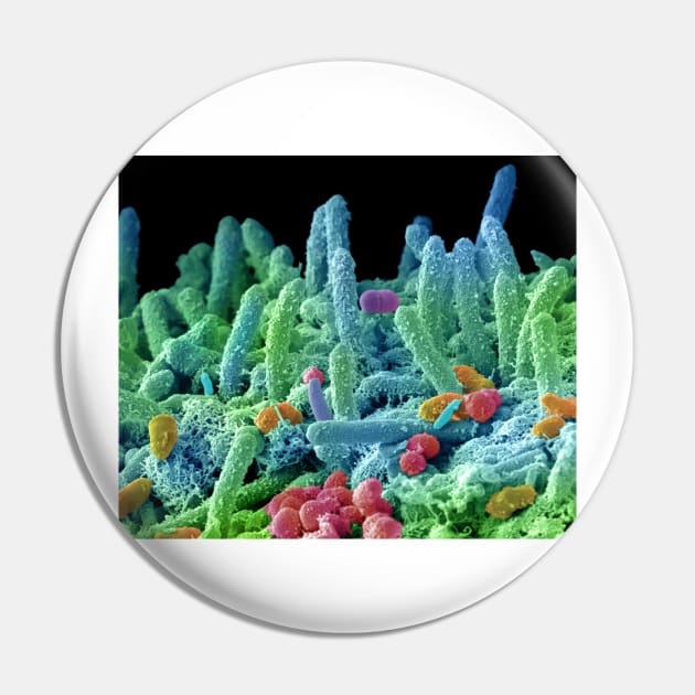 Oral bacteria, SEM (C029/3194) Pin by SciencePhoto