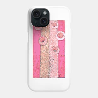 Bacon and Eggs Phone Case