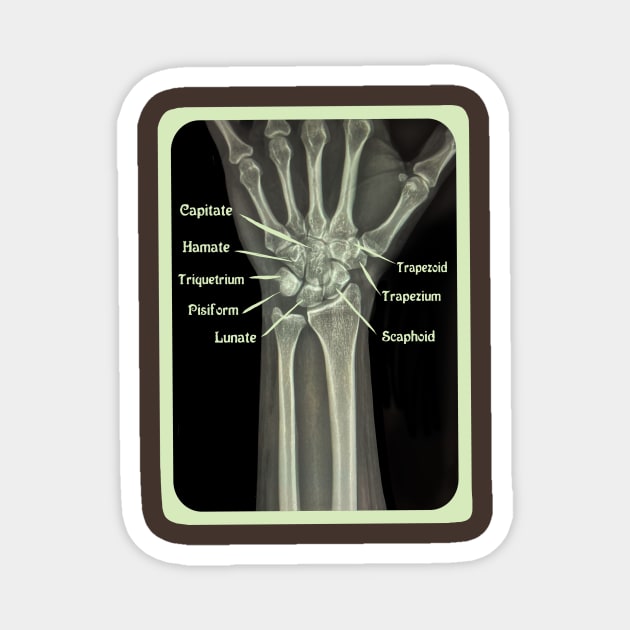 XRAY of Carpal Bones Mixed Media Magnet by ckrickett