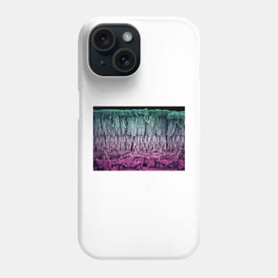 Retina layers, SEM (C018/0521) Phone Case