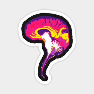 Brain with Brainstem in Vibrant Colors Magnet