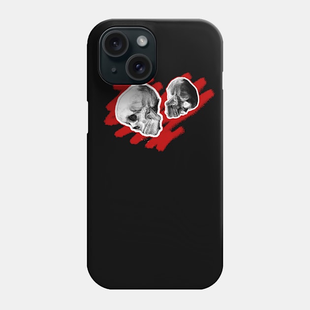 Two skulls - one love Phone Case by Severinochka